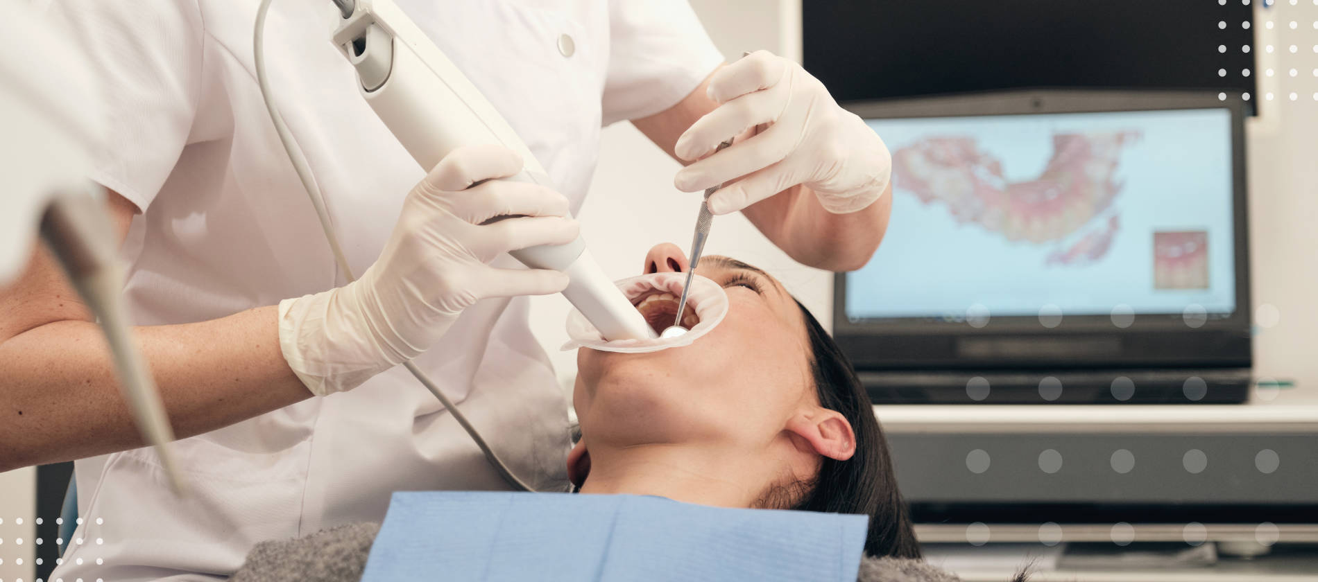 Usamos el Escaner intraoral 3D Shape