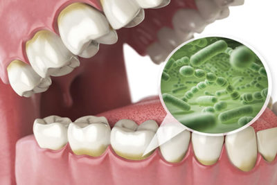 Importancia de la higiene oral
