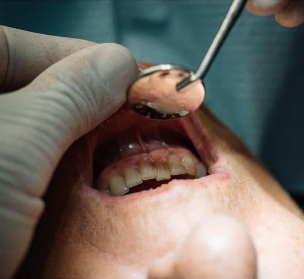 El cigarrillo y su relación con la enfermedad periodontal